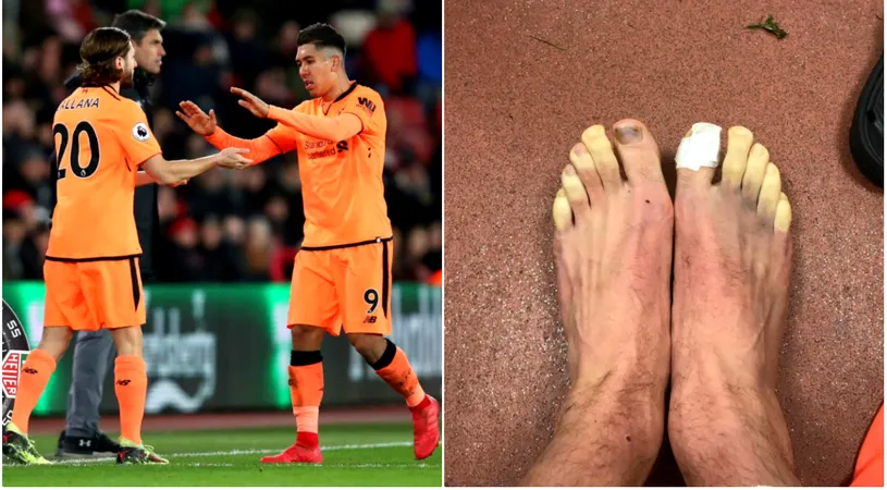 Unui fotbalist de la Liverpool i-au înghețat picioarele în partida cu Southampton. Cum a fost posibil | FOTO