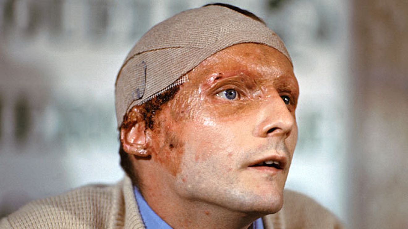 SPECIAL | "Șobolanul", viața cu cicatrici și șepcile. „În toți acești ani am văzut oameni care au murit în fața mea". Mărturisirea lui Niki Lauda, la 40 de ani de la evenimentul care l-a lăsat desfigurat 