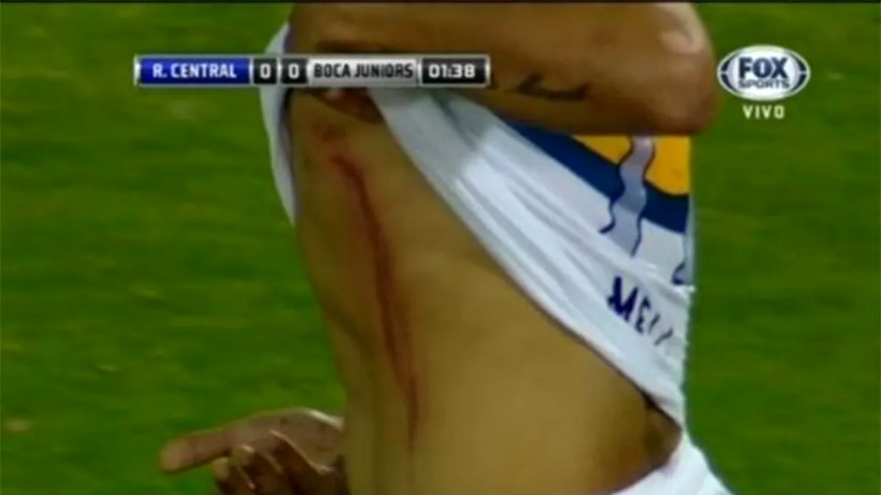 VIDEO | Violențe la meciul dintre Rosario și Boca Juniors. Doi jucători ai oaspeților au fost loviți cu obiecte și pietre aruncate din tribună 