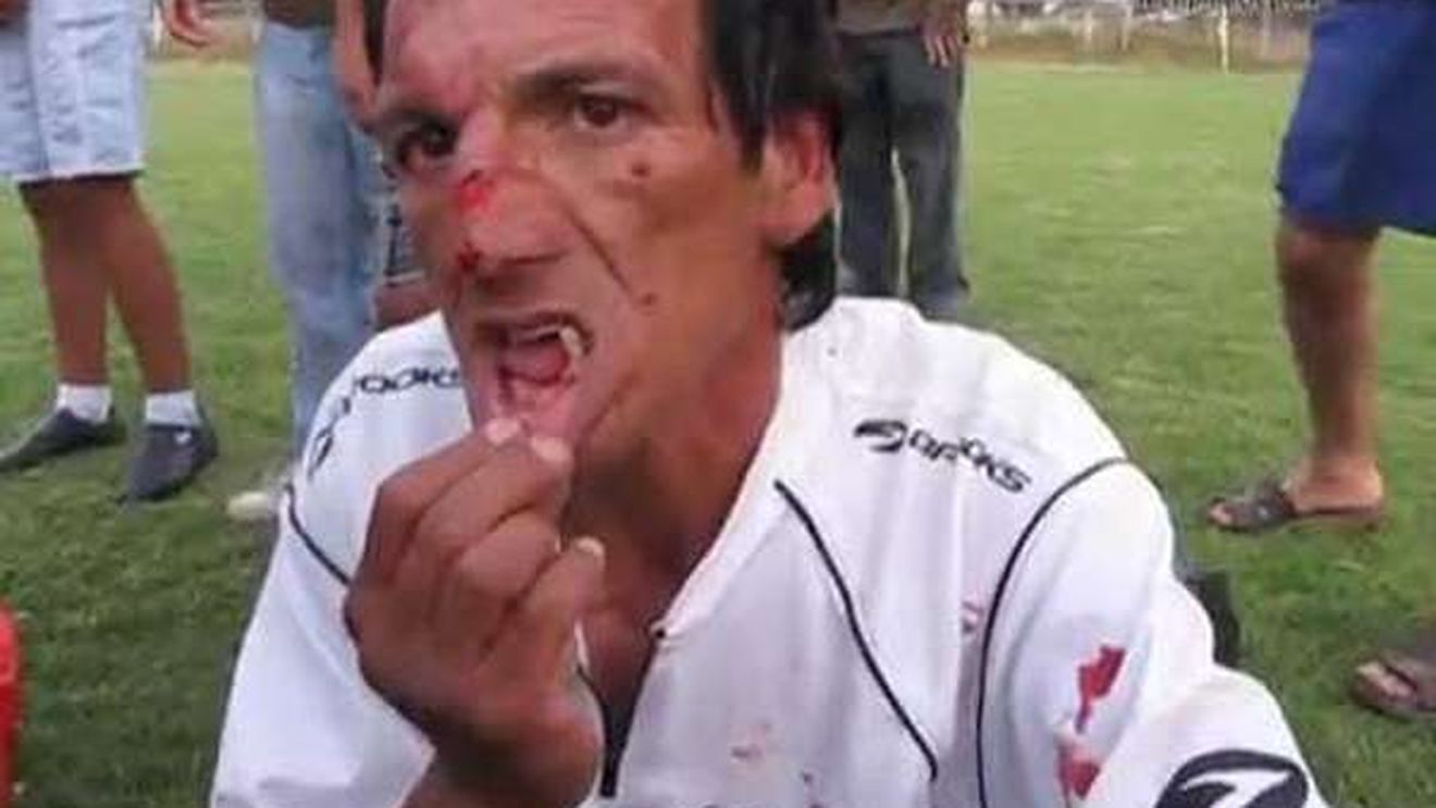 VIDEO Clipe de coșmar pentru o brigadă de arbitri!** Un asistent și-a pierdut mai mulți dinți în urma loviturilor aplicate de suporteri