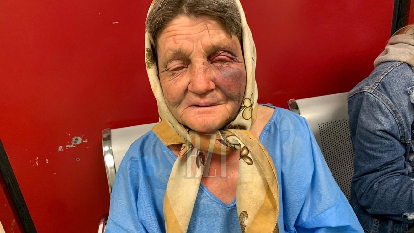 Bătrână, snopită în bătaie de 3 tineri, în gara din Iași. Femeia a ajuns de urgență la spital, cu răni pe tot corpul! "Maică, mă băteau și râdeau"
