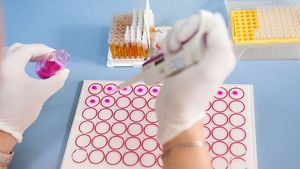 O dublă campioană olimpică își donează creierul