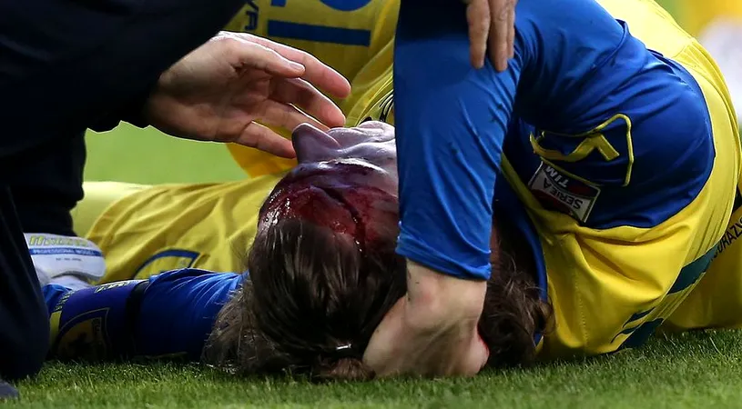 FOTO și VIDEO | Film de groază în partida Juventus - Chievo din Serie A. Frey, plin de sânge după un duel aerian cu Evra