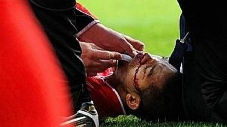 Un fotbalist din Tunisia, aproape omorât de o piatră aruncată din tribune