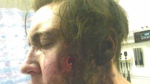 Fost fotbalist, mutilat de explozia unei țigări electronice. La ce riscuri sunt supuși cei 3,7 milioane de români care folosesc E-Cigarette | VIDEO ȘOCANT