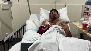 A ales să facă operația riscantă pe care mulți chirurgic au refuzat-o. I s-a pus grefă la mușchiul pectoral de la un cadavru