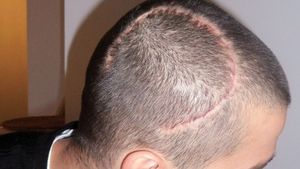 VIDEO | Declarația înfiorătoare a lui Cristi Chivu: "Nu mai simt nimic cu degetele mâinii stângi...Mi-am pus mâna în cap și nu mai aveam os, era o gaură!"