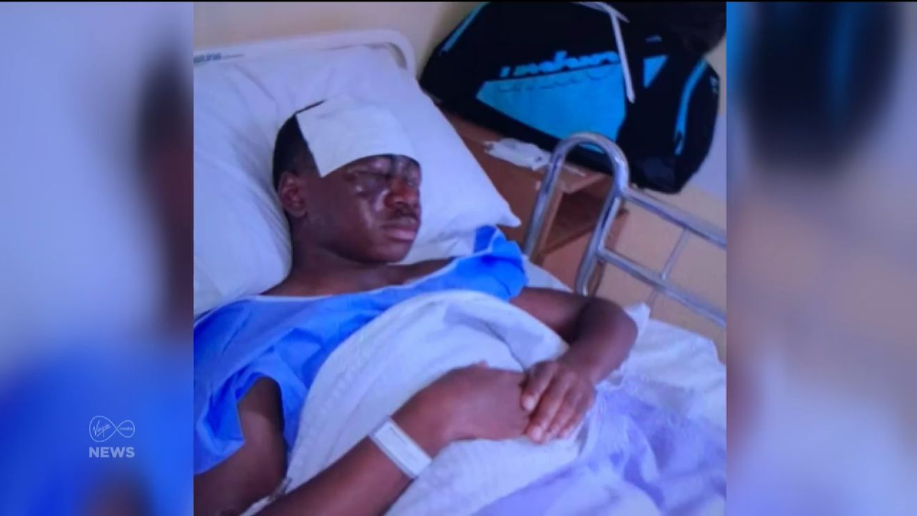 VIDEO | E inuman! Dramă fără margini pentru un tânăr fotbalist irlandez: a fost orbit cu acid, în urma unui atac sălbatic. Imagini cu un puternic impact emoțional