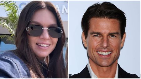 Simona Halep și-a tras zâmbet de Hollywood! Sportiva și-a pus aparat dentar invizibil, la fel ca Tom Cruise și Serena Williams: „Este vedeta printre trendurile stomatologice". FOTO