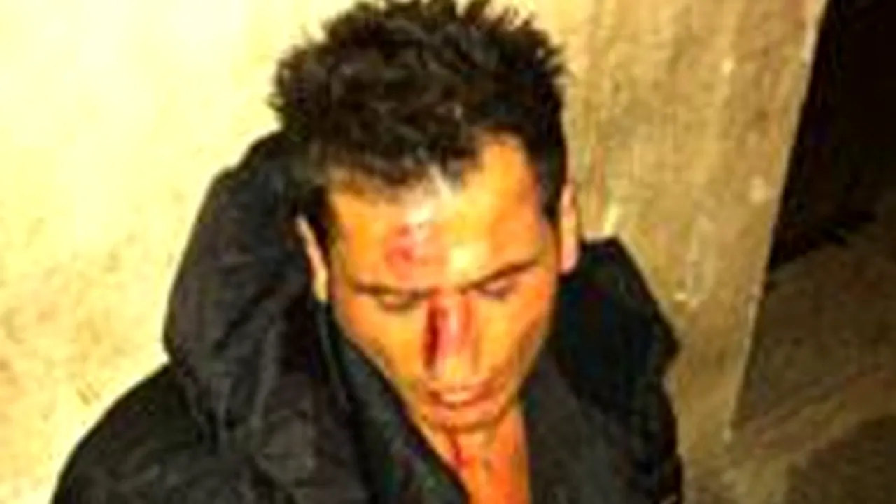 FOTO ȘOCANT** Așa arăta chelnerul din Firenze, imediat după ce a fost bătut de Adrian Mutu