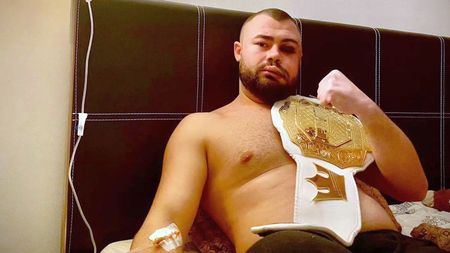 Decizie șoc luată de românul desfigurat în palme pentru câteva mii de euro: ce vrea să facă pentru bani! | EXCLUSIV