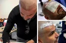Adrian Mutu și-a făcut implant de păr. Reacția fabuloasă a „Briliantului” când a explicat de ce a făcut asta