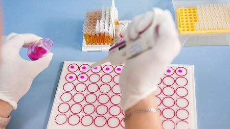 O dublă campioană olimpică își donează creierul