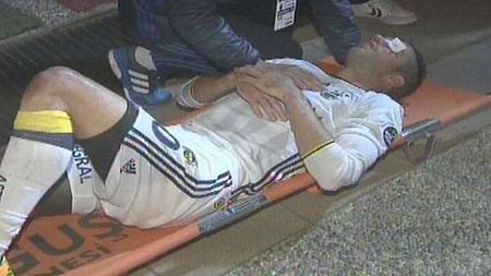 FOTO | Robin van Persie, accidentare teribilă în ultima etapă de campionat din Turcia! Olandezul a fost în pericol să-și piardă ochiul stâng