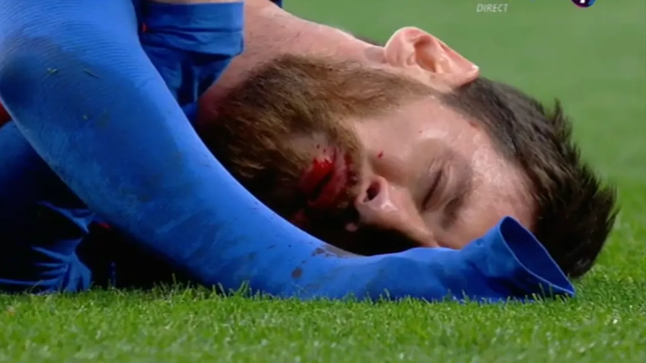 FOTO | Imagini șocante în El Clasico! Marcelo l-a umplut de sânge pe Messi