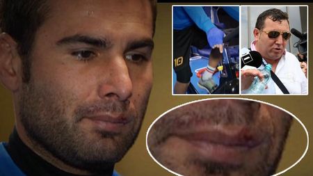 Falimentul experimentului Mutu: adus la Petrolul pentru 25.000 â‚¬ pe lună, atacantul a fost rănit în urma conflictului cu un personaj controversat. "Și-a prins degetul în ușa de la mașină, a fost la spital"