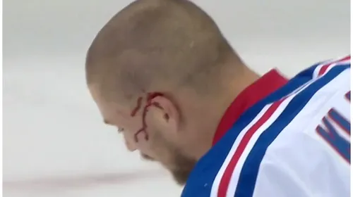 „This is hockey”: 13 copci pentru ca medicii să îi coasă o parte a urechii la loc. A revenit pe gheață și a dat golul victoriei