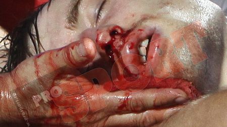 VIDEO SÃ‚NGEROS** Liga I, la un pas de o nouă dramă! Faza din ultimele secunde care "a înghețat" stadionul