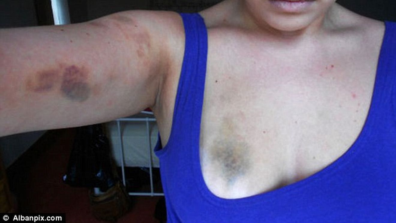 Cum a scăpat un instructor de fitness nepedepsit, după ce și-a bătut măr iubita. FOTO