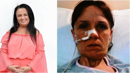 "Mi-am pierdut sănătatea și soțul" FOTO | Această femeie ajunsese să cântărească sub 35 de kg. Pericolele dietei dusă la extrem