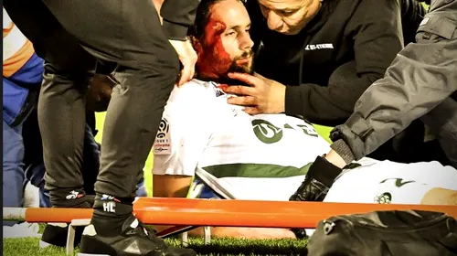 Clipe de groază în Ligue 1! Subotic a fost făcut K.O. de propriul portar și transportat de urgență la spital. VIDEO | Momentul dramatic