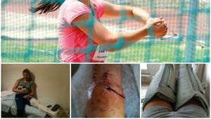 Lacrimi de sânge. Genunchiul traumatizat și cicatricea de 15 centimetri. "Trei zile și trei nopți n-am închis un ochi" FOTO 