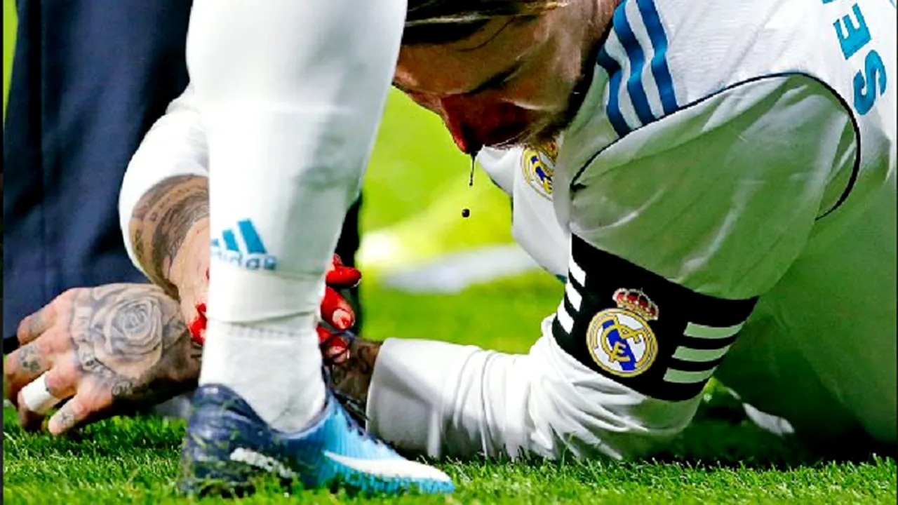 FOTO | Cum arată nasul lui Sergio Ramos după meciul cu Atletico Madrid