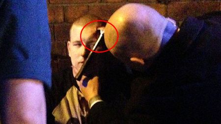 FOTO: Rugbyst atacat cu un ciocan în fața unui club