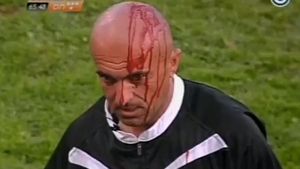 VIDEO TERIFIANT** A avut noroc că a scăpat cu viață! Suporterii i-au crăpat capul unui tușier