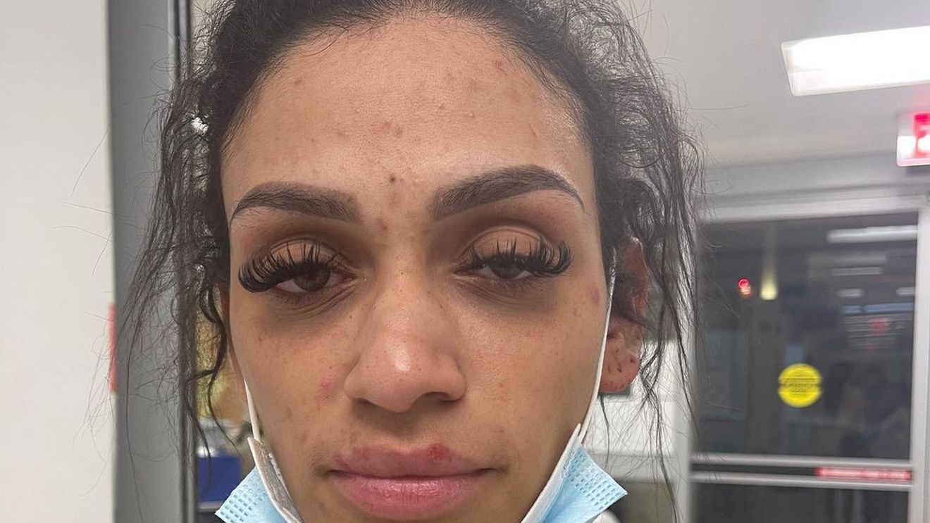 Soția celebrului sportiv, mărturii cutremurătoare: „M-a abuzat în toate modurile! Copiii au fost martori!” .E șocant ce scrie pe raportul medico-legal: atac prin strangulare, comoție cerebrală, fractură nazală!