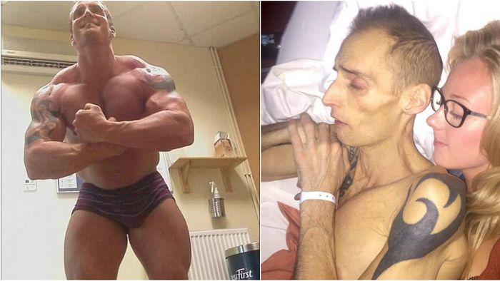 FOTO |  Obsesia pentru a fi "mai mare" i-a adus sfârșitul. De la 130 de kg, ajunsese doar piele și os. De ce a murit acest culturist la 39 de ani