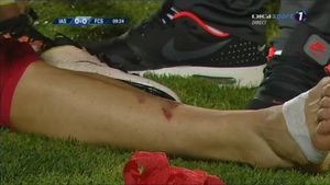 Atenție, imagini dure! După Tănase, Steaua a fost la un pas de o nouă accidentare horror. FOTO | Intrarea criminală a lui Boiciuc i-a găurit piciorul lui Ovidiu Popescu. Primul verdict