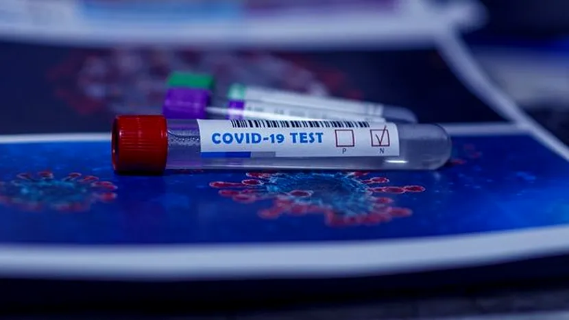 Ce se va întâmpla cu testele de coronavirus dacă numărul cazurilor noi va crește. Alexandru Rafila a făcut anunțul