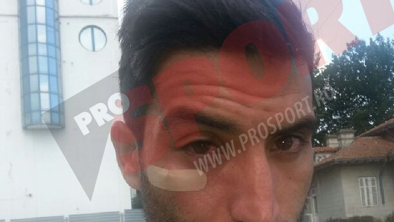 Hamza, bătut de bodyguarzii lui Radu Mazăre! Reacția primarului, surprinzătoare: "Era agresiv, poate drogat. Nu știu dacă a fost lovit!" FOTO EXCLUSIV