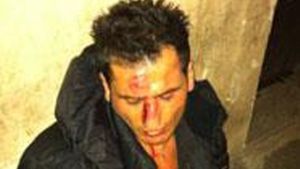 FOTO ȘOCANT** Așa arăta chelnerul din Firenze, imediat după ce a fost bătut de Adrian Mutu