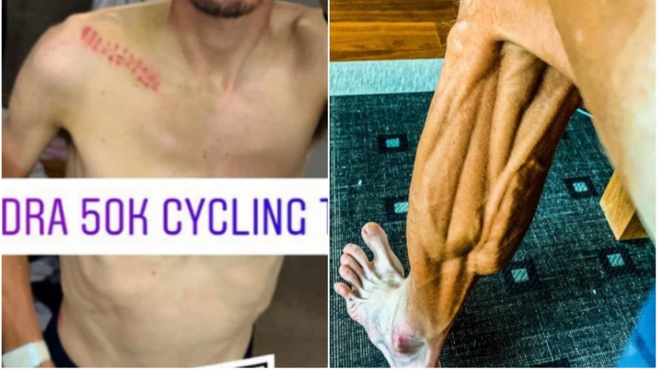 Șocant! Cum arată piciorul unui sportiv după 10 luni de suspendare din cauza dopajului. Transformarea suferită FOTO