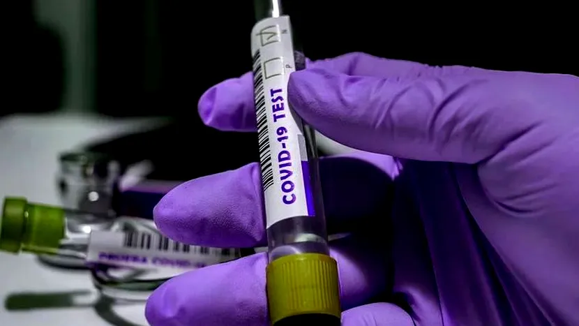 Bilanț coronavirus, 24 februarie. 10.749 de cazuri noi și 105 decese, în ultimele 24 de ore