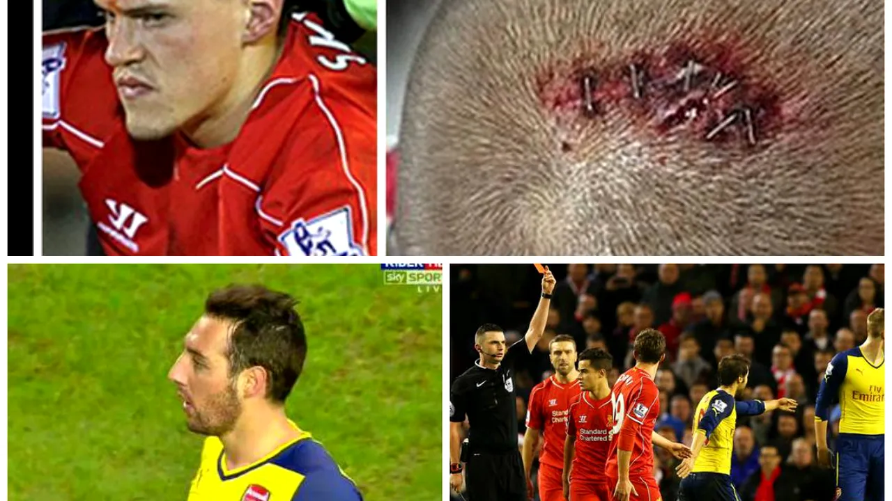 FOTO și VIDEO | Un meci cu de toate. Arsenal - Liverpool a avut accidentări horror, un fotbalist eliminat și multe glume la final. Ce au inventat fanii despre Borini și Cazorla