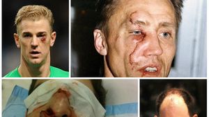 Sport, pe muchie de cuțit! Top zece accidentări teribile care n-au încheiat cariere. Selecție fără luxații sau oase sfărâmate