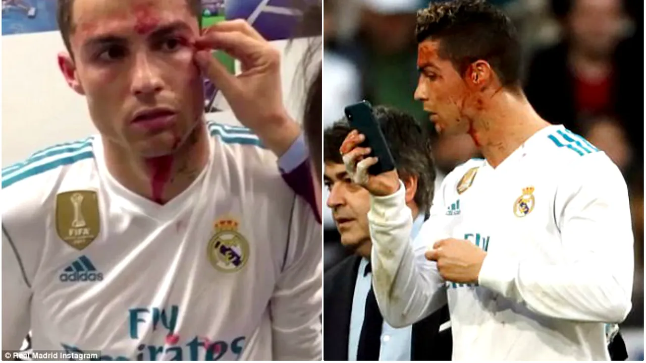 Primele imagini cu rana adâncă de pe fața lui Ronaldo! VIDEO din vestiarul lui Real Madrid după ce lusitanul a intrat pe mâna medicilor