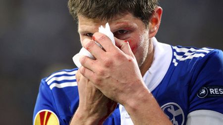 Așa joacă AEK Larnaca șansa pentru primăvara EL!** Huntelaar, suspect de fractură de piramidă, Marica zâmbește iar