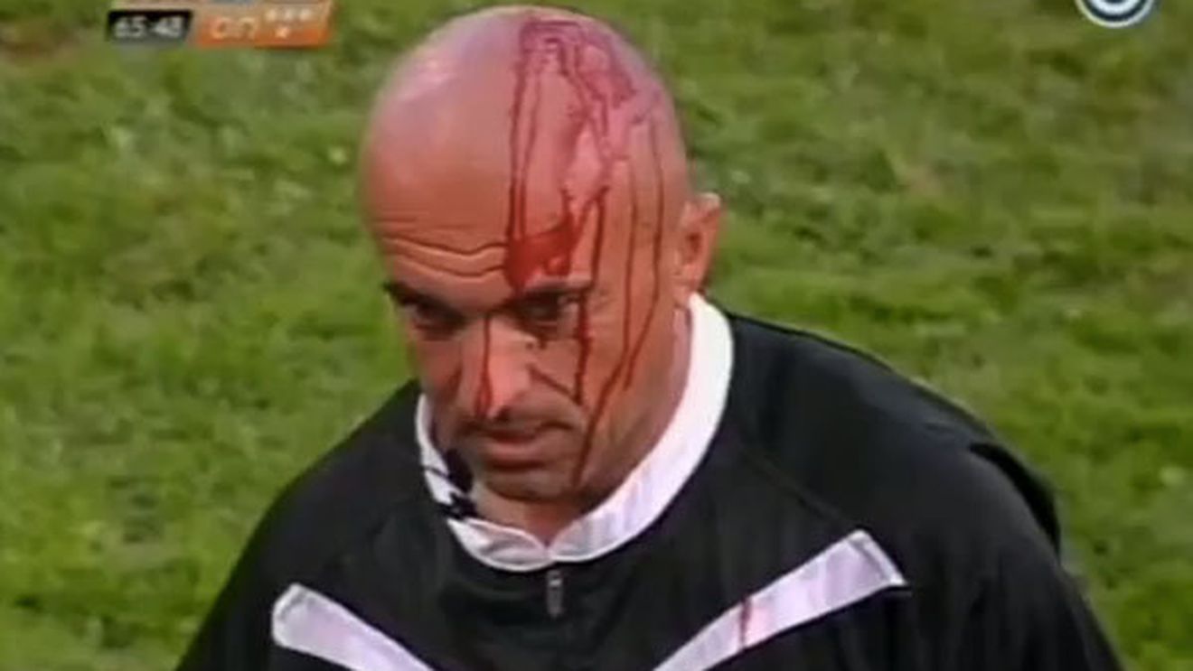 VIDEO TERIFIANT** A avut noroc că a scăpat cu viață! Suporterii i-au crăpat capul unui tușier