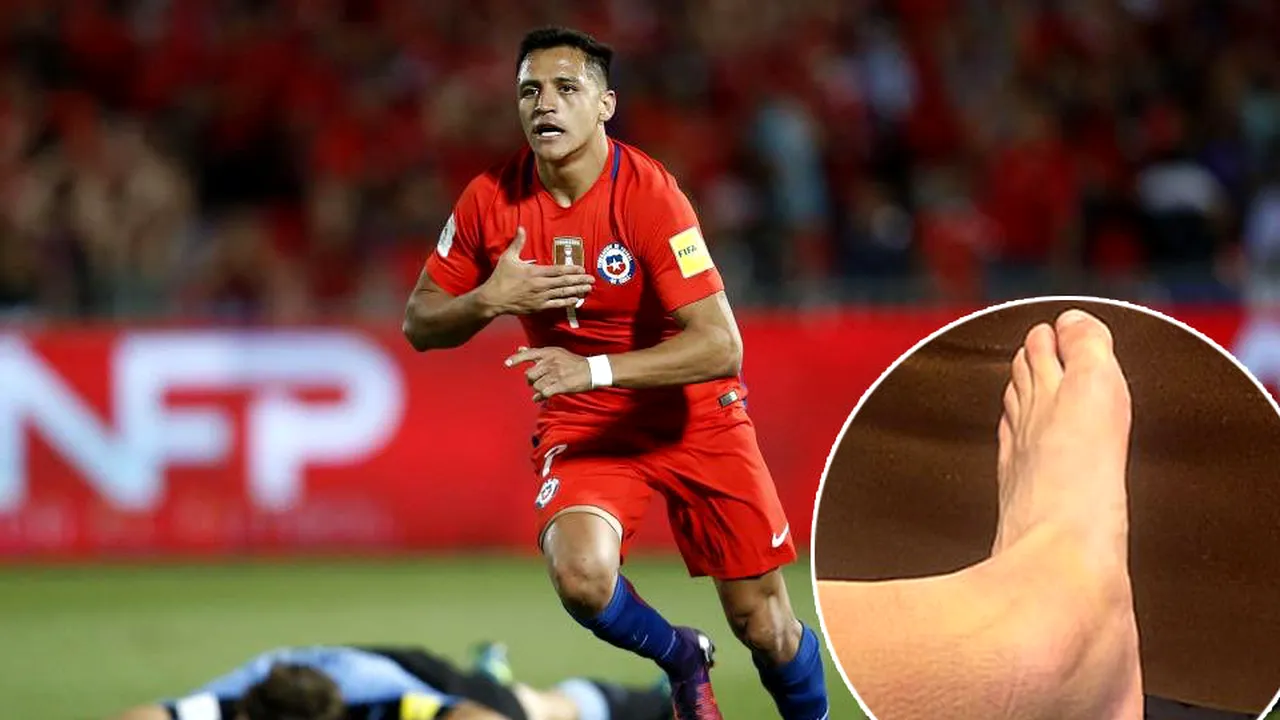 Și-a speriat fanii! FOTO | Cum arată glezna lui Alexis Sanchez după ultimul meci
