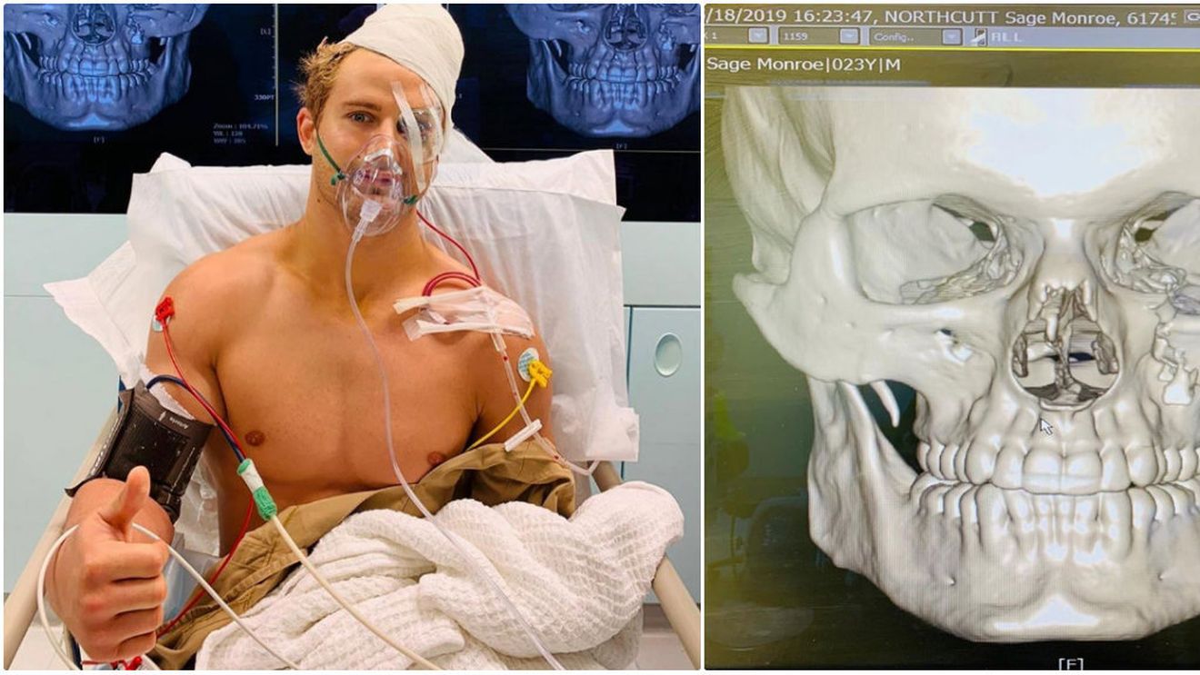 Meciul s-ar fi putut lăsa cu o tragedie! A fost făcut KO: craniul i-a fost fracturat în opt locuri, iar operația a durat nouă ore | VIDEO