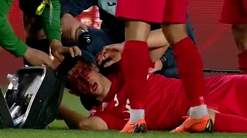 Clipe de groază pe „Ilie Oană”. FOTO | Un jucător a rămas întins pe gazon, plin de sânge, în urma unui duel aerian