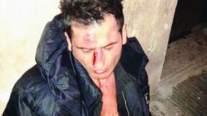 Albanezul bătut de Mutu, sub control psihiatric! "A plecat înapoi în Kosovo"