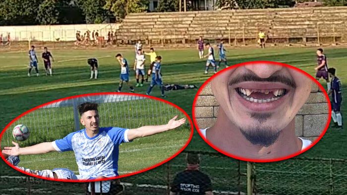 Unul dintre jucătorii acuzați de blat de echipa sa, desfigurat în partida din Liga 3 pe care ar fi pariat. ”Costă 50.000 de lei toată intervenția”. Imagini cu puternic impact emoțional