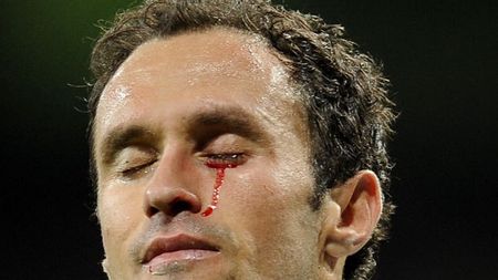 VIDEO&FOTO ȘOCANT** Carvalho, cu "lacrimi" de sânge, după ce a primit un cot în ochi de la un adversar