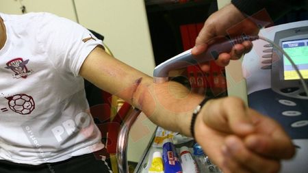 FOTO EXCLUSIV** Așa arată mâna lui Dani Coman după intrarea lui Prepeliță! VEZI cât va lipsi "Robocop"