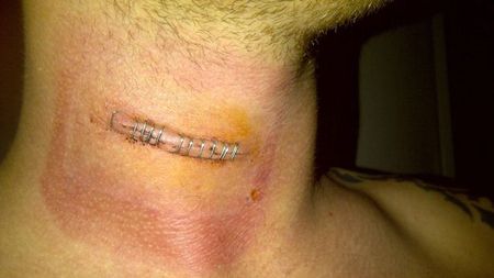 De la extaz la agonie!** Un golgheter și-a rupt gâtul după ce a marcat golul victoriei. Nu va mai juca fotbal niciodată! Ce s-a întâmplat: